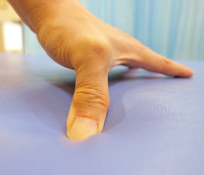 よこい院長の親指の写真